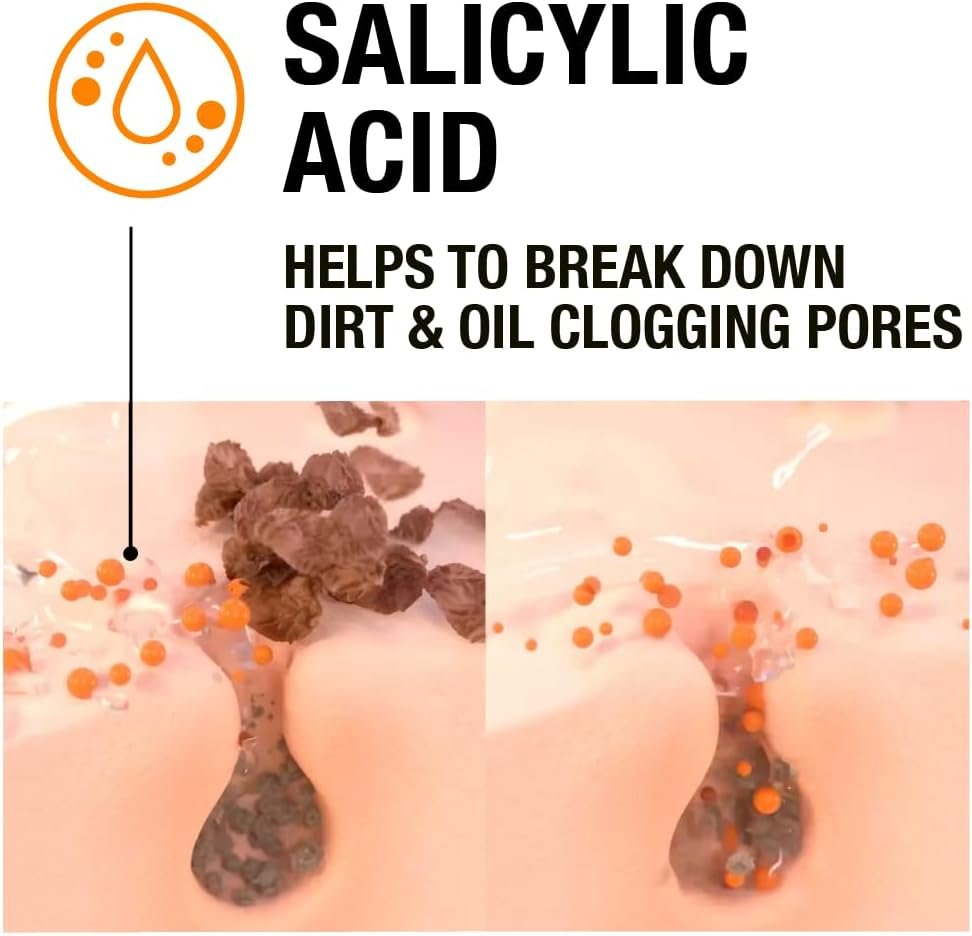 Neutrogena Clear and Defend SOS Gel (15ml), Oil-Free Face Gel for Spot-Prone Skin, with Purifying 0.5% Salicylic Acid to Help Reduce the Appearance of Spots - Image 6