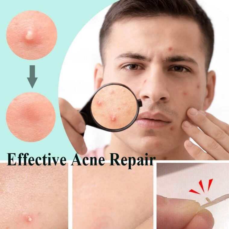 Zemolo 300pcs Pimple Patches Hydrocolloid Acne Stickers with Tea Tree Oil Spot Cover Patches Day & Night Whiteheads Acne Absorbing Blemish Patches Invisible Spot Treatment Stickers - Image 4