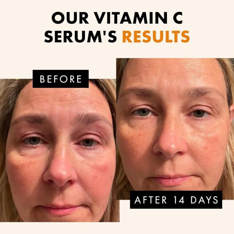 Eclat Skincare Glow Up Vitamin C Serum - Vitamin C Serum for Face with Hyaluronic Acid, Ferulic Acid & Vit E - Skin Brightening Face Care - Anti Aging, Hydrating & Dark Spot Lightening 30ml - Image 7