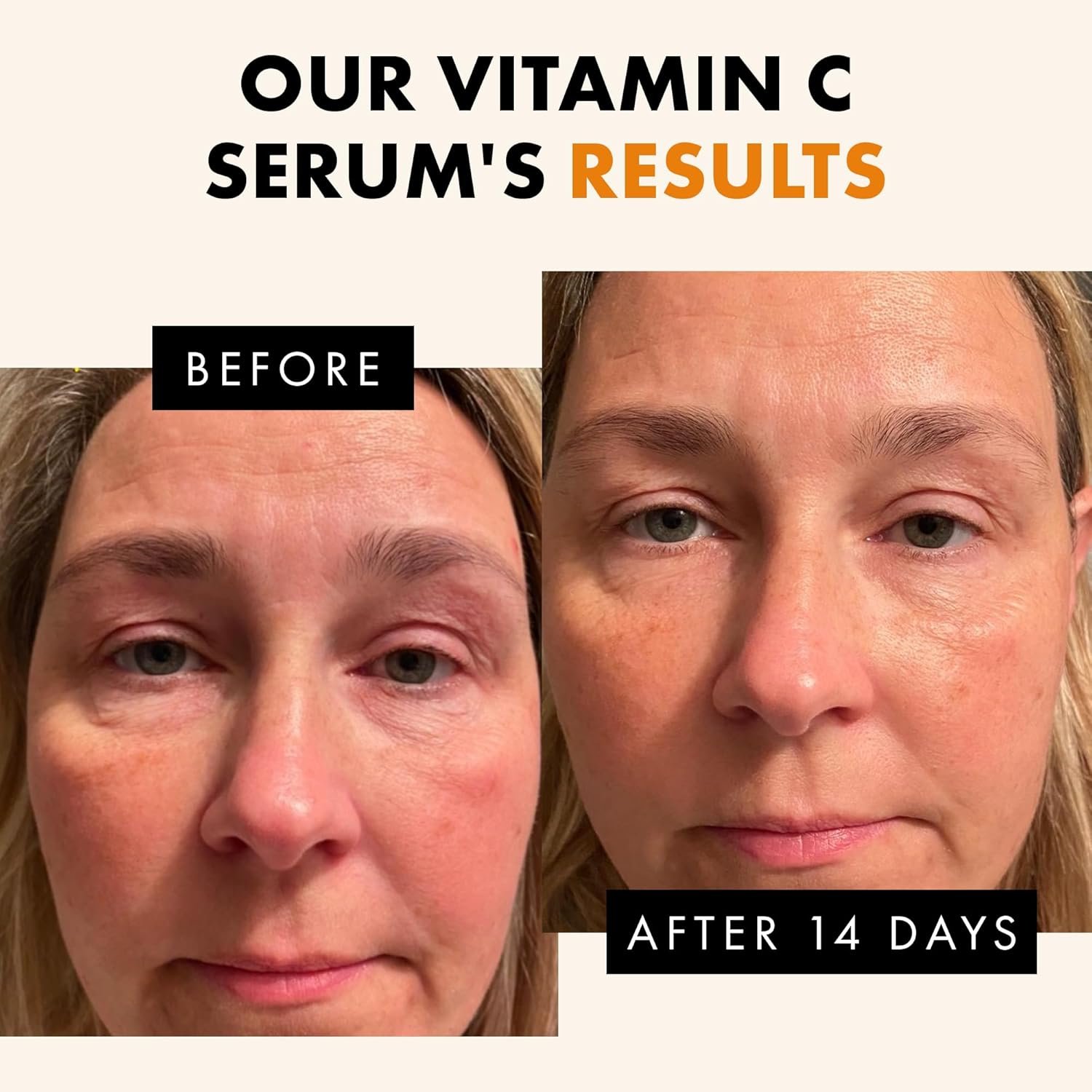 Eclat Skincare Glow Up Vitamin C Serum - Vitamin C Serum for Face with Hyaluronic Acid, Ferulic Acid & Vit E - Skin Brightening Face Care - Anti Aging, Hydrating & Dark Spot Lightening 30ml - Image 7