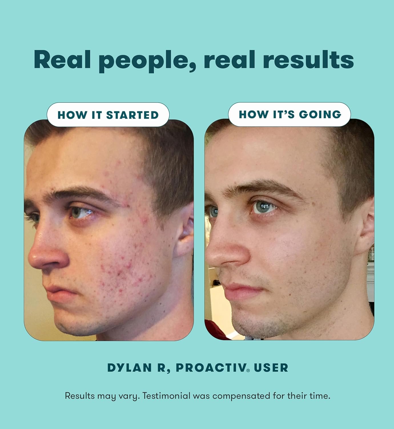 Proactiv Solution Refreshing Facial Cleanser, Blemish Prone Skin, 180 ml (Pack of 1) - Image 6