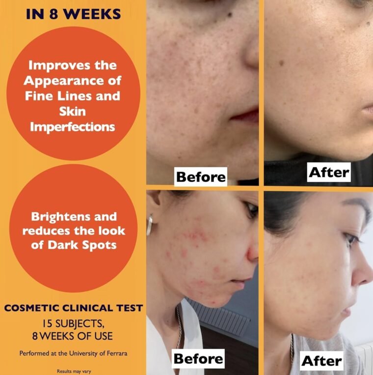 Big 2.11oz. Organic Vitamin C Serum for Face with Hyaluronic Acid & Niacinamide. Anti-Dark Spots, Wrinkle, Aging Brightening Facial and Eye Contour Vitamin C Serum. Brightening Women and Men Skin Care - Image 5