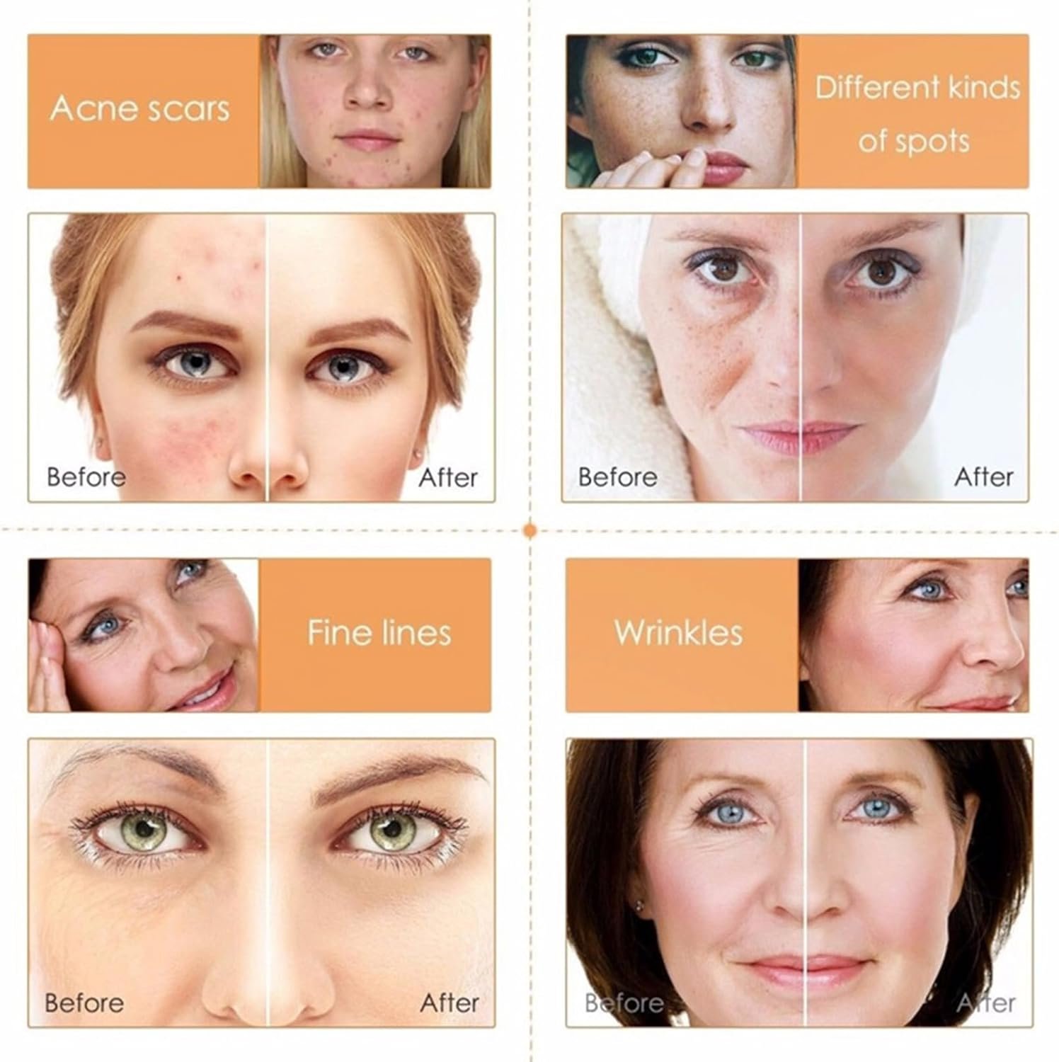 Skincare Gift Set for Her,Vitamin C Skin Care-With Hyaluronic Acid&Vitamin C,Skincare Routine,Cleanser, Face Serum, Cream,Toner, Eye Cream - Anti- Aging,Brightening (One Size, Vitamin C-SetC-5pcs) - Image 5