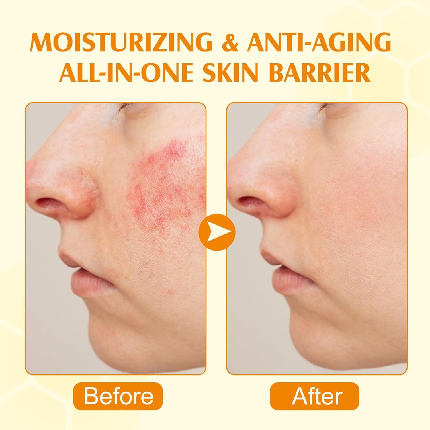 Beef Tallow Skin Care, Beef Tallow and Honey Cream 120g, Beef Tallow Moisturizer, Natural Organic Grass - Fed Whipped Beef Tallow and Honey Balm - Deeply Moisturizing for Face & Body, Softens Dry - Image 5