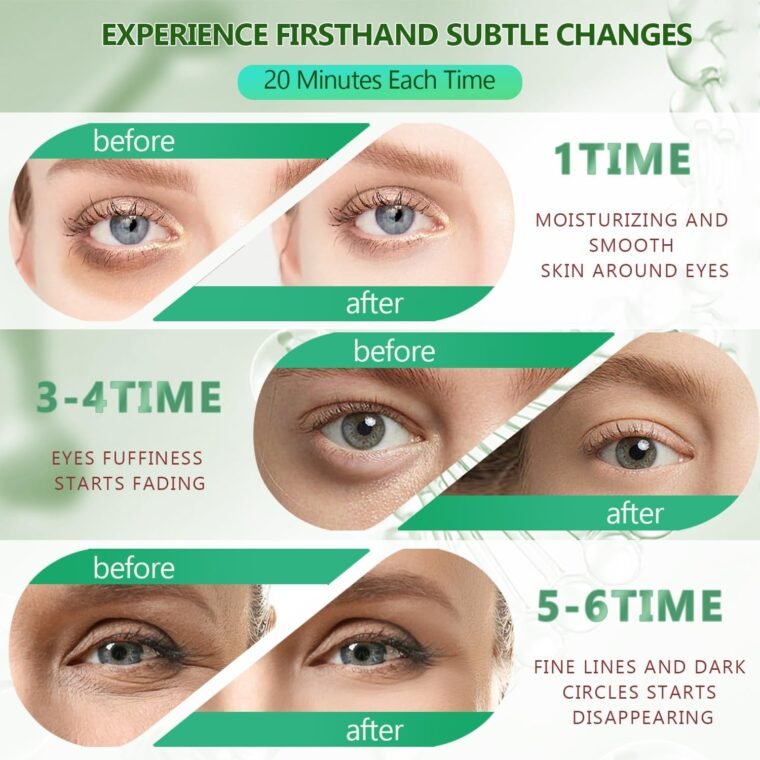 Green Gold Undereye Mask (60 Pcs), Collagen Hydrating Gel Pads, Reduce Puffiness, 30 Pairs Under Eye Patches for Dark Circles Puffy Eyes Treatment, Wrinkle, Women Men Beauty Personal Skin Care Product - Image 5