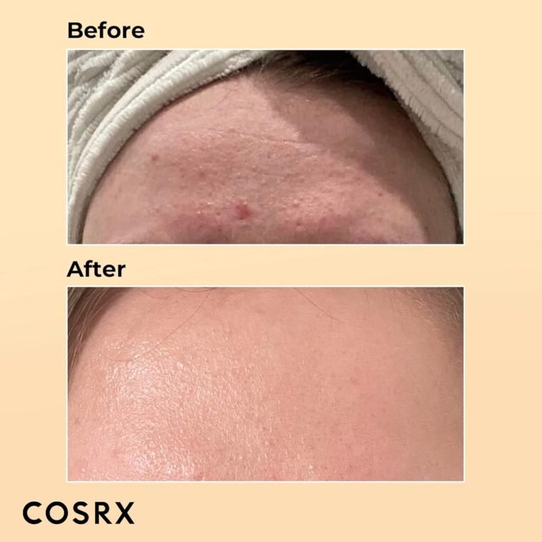 COSRX Advanced Snail 96 Mucin Power Essence 100ml, Skin Repair & Hydrating Serum, Snail Secretion Filtrate 96% & Hyaluronic acid, Korean Skincare, Animal testing free - Image 2