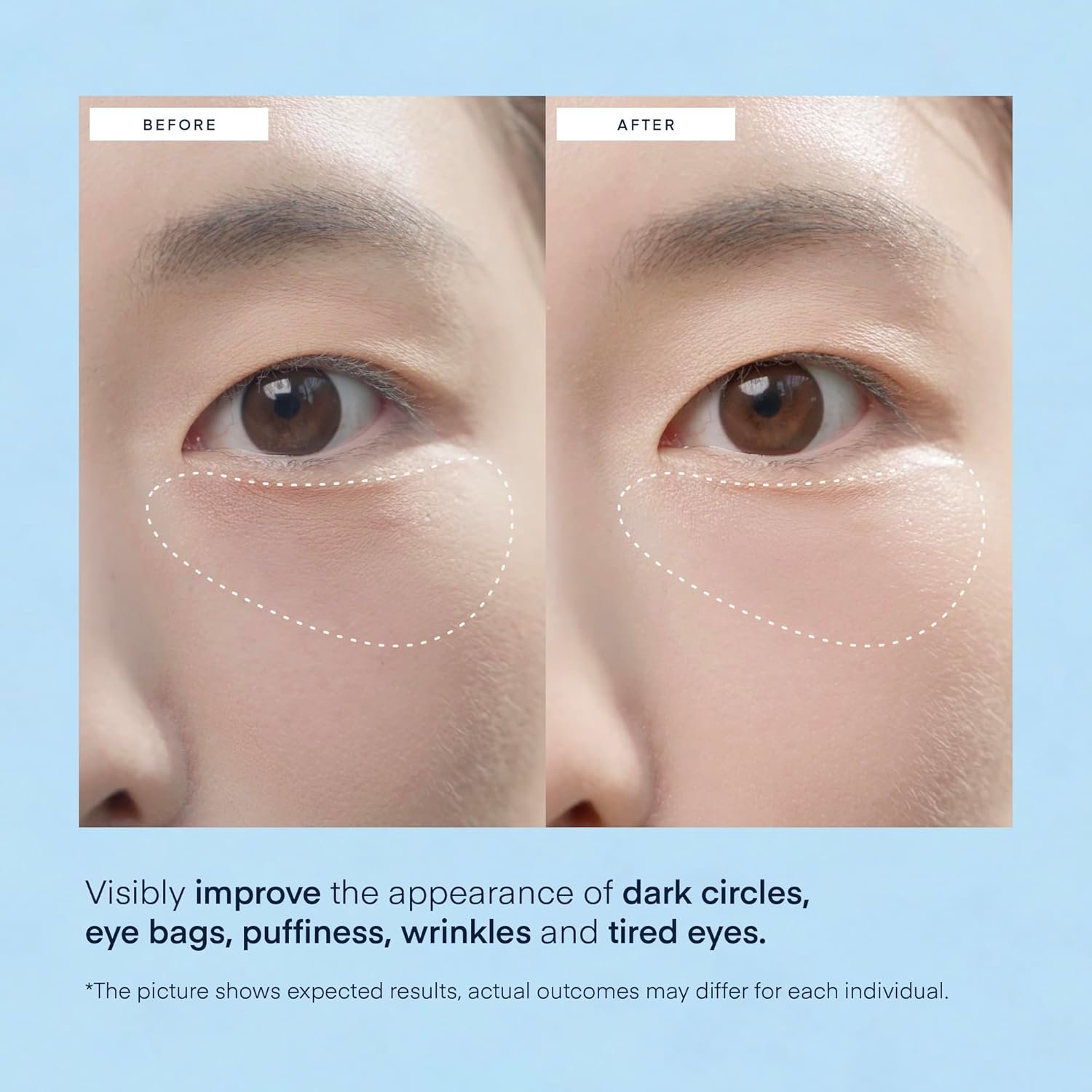 Korean Under Eye Gel Patches: Eye Masks for Puffy Eyes Dark Circles & Wrinkles with Caffeine Hyaluronic Acid & Niacinamide - Brightening Hydrating & Cooling Hydrogel Skincare Pads - 30 Pairs, Vegan - Image 4