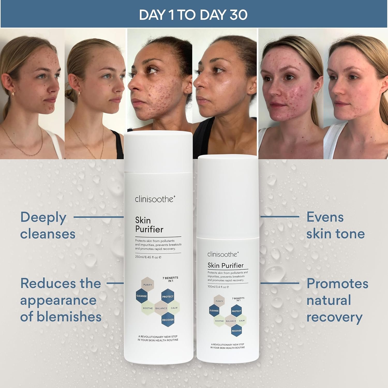 Clinisoothe+ Skin Purifier 250ml Pour Top - with Hypochlorous Technology to Protect The Skin from pollutants and impurities, Prevent breakouts and Promote Rapid Recovery - Image 4