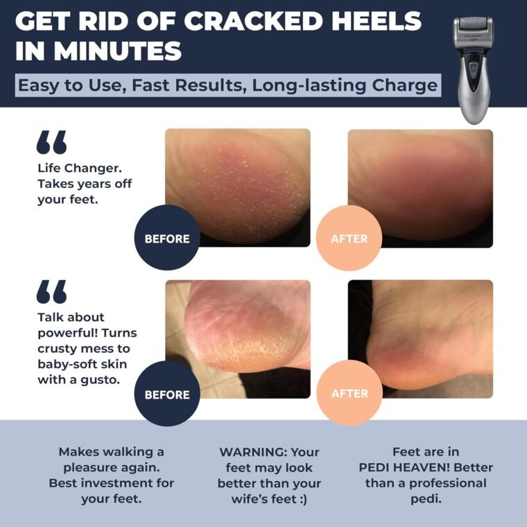 Electric Hard Skin Remover for Men by Own Harmony: USA's Best Rated Callus Remover- Rechargeable Pedicure Tools w 3 Coarse Rollers, Velvet-Smooth Foot Care Professional Spa Pedi Feet File (USB Cord) - Image 2