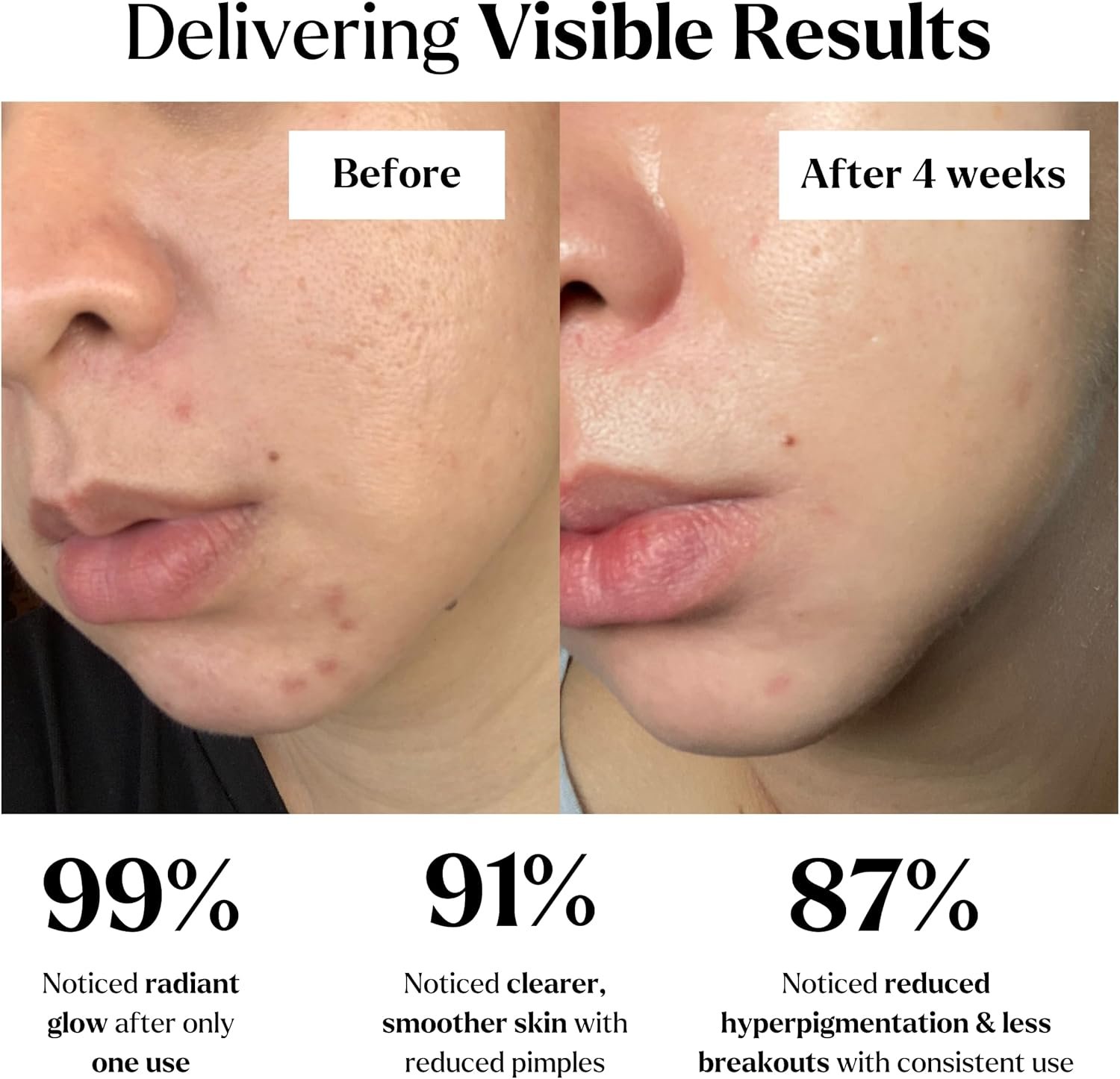 VogueNow Clay Mask Gift Pack of 4 Jars (400g) With Cute Headband & Brush | Premium Clay Face Mask | Turmeric Vitamin C, Green Tea, Rose, Dead Sea Mud For Face | Spa Gift set for Women - Image 4